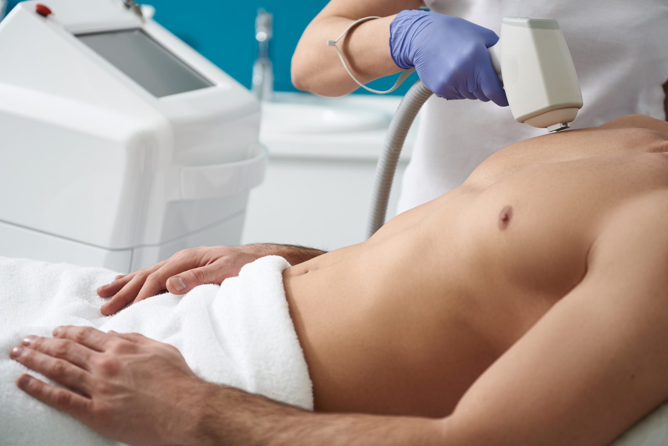 Laser hair removal procedure of chest to man